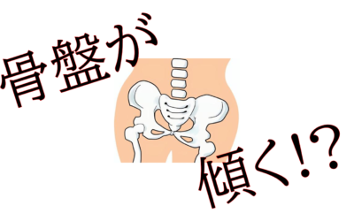 【骨盤矯正】骨盤が傾く？